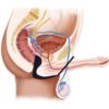 sextoys-plug-cockring-anal-sexe-shop-nantes-sexity